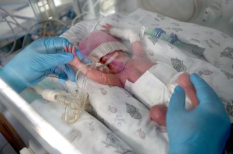 "Najmniejsze dziecko świata" po 13 miesiącach pobytu w szpitalu w końcu może wrócić do domu. Jaki jest stan jego zdrowia?