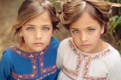 Jak dziś wyglądają "najpiękniejsze bliźniaczki świata"? Karierę w modelingu zaczęły już jako 1,5-roczne dziewczynki