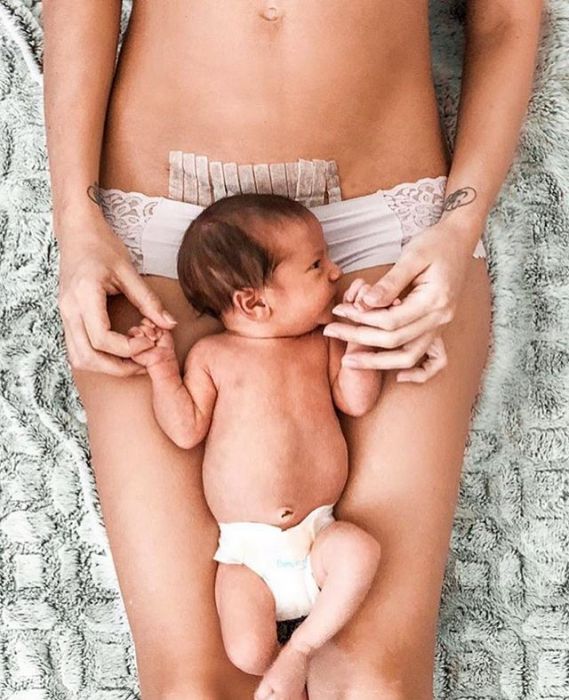 Mamy pokazują brzuch po porodzie: wzruszające zdjęcia