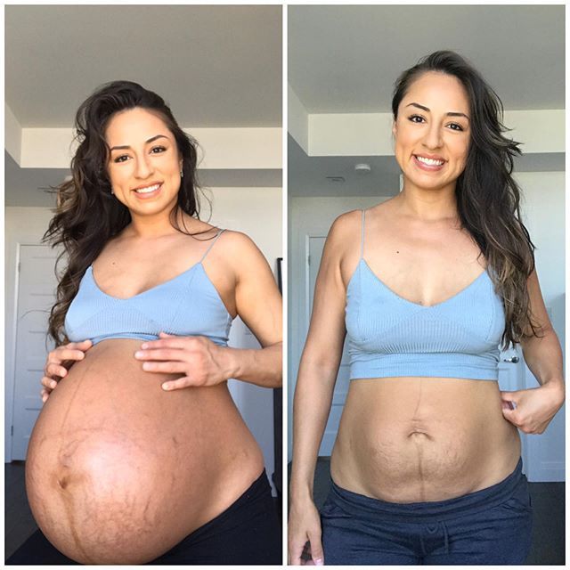 Nubbia Quezada pokazała brzuch po ciąży bliźniaczej